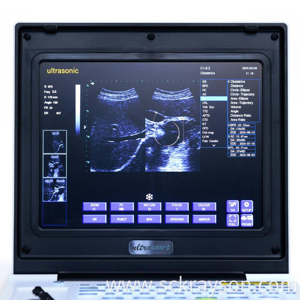 Laptop Ultrasound Screen 7